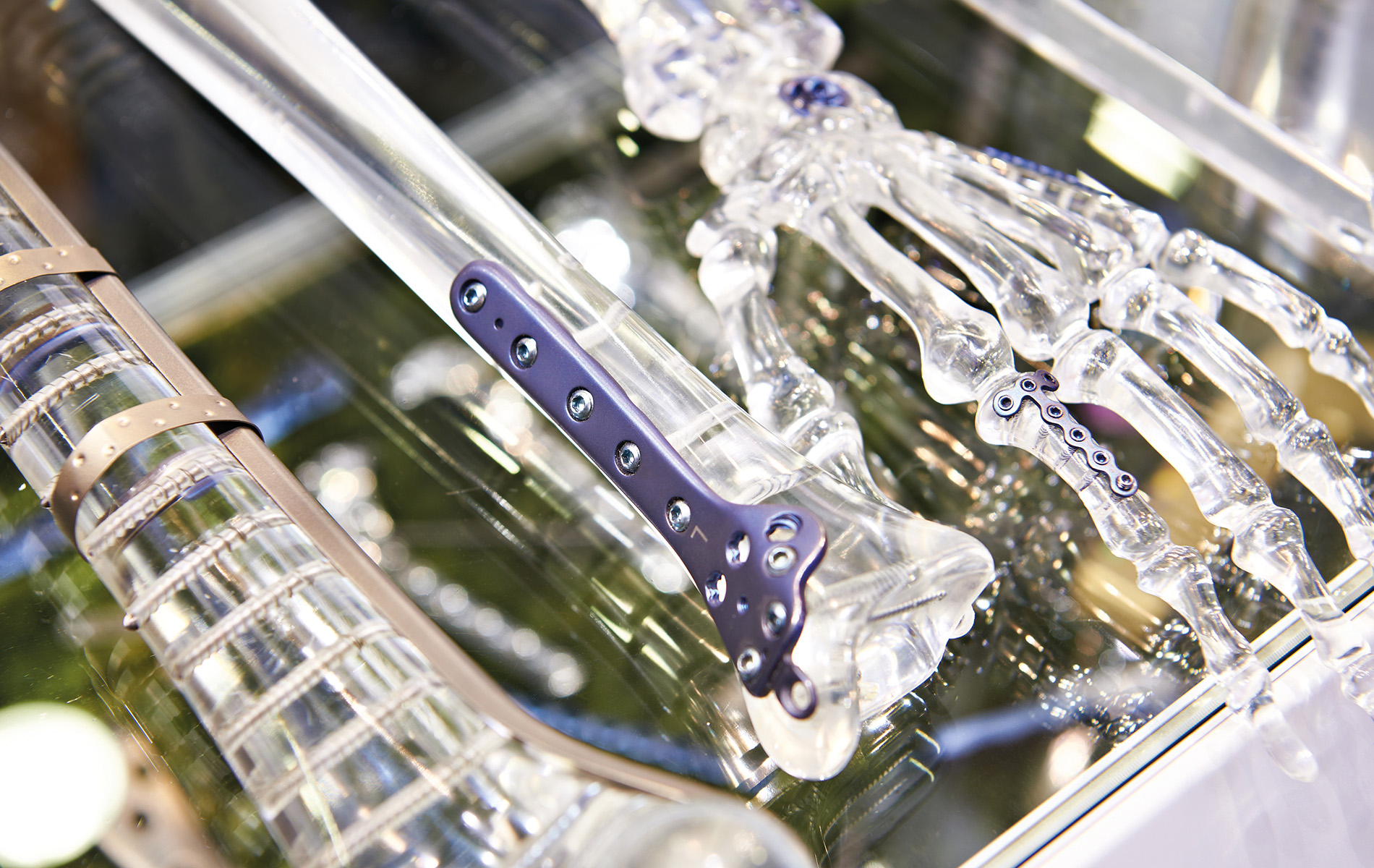 Bestandsverfolgung aufgrund von Überbeständen